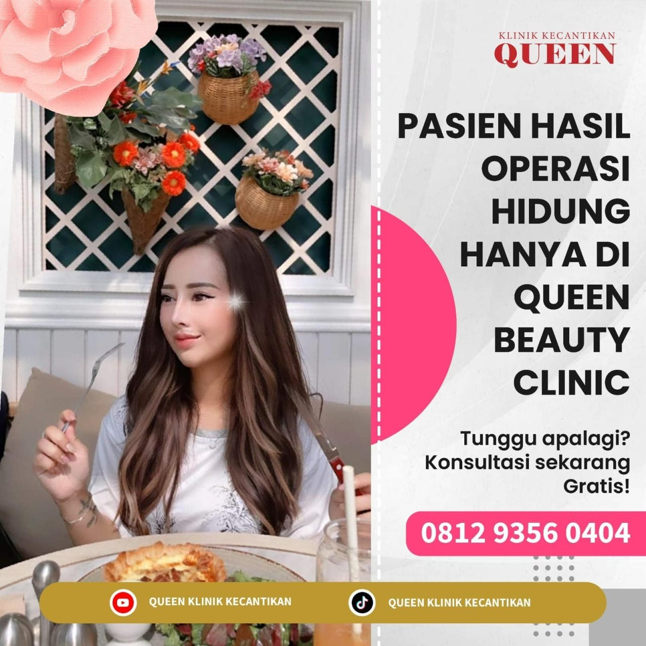 Hasil Rhinoplasty Queen Plastic Surgery, foto 36