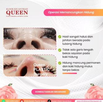 Hasil Rhinoplasty Queen Plastic Surgery, foto 48