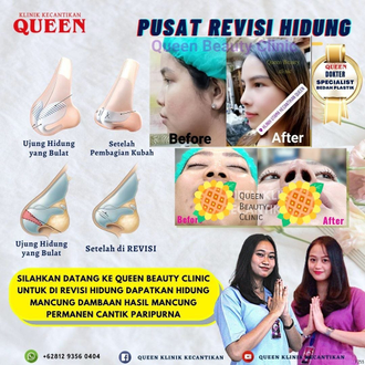 Hasil Rhinoplasty Queen Plastic Surgery, foto 37