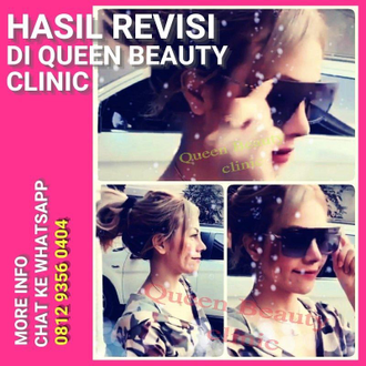 Hasil Rhinoplasty Queen Plastic Surgery, foto 32