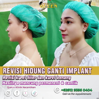 Hasil Rhinoplasty Queen Plastic Surgery, foto 44