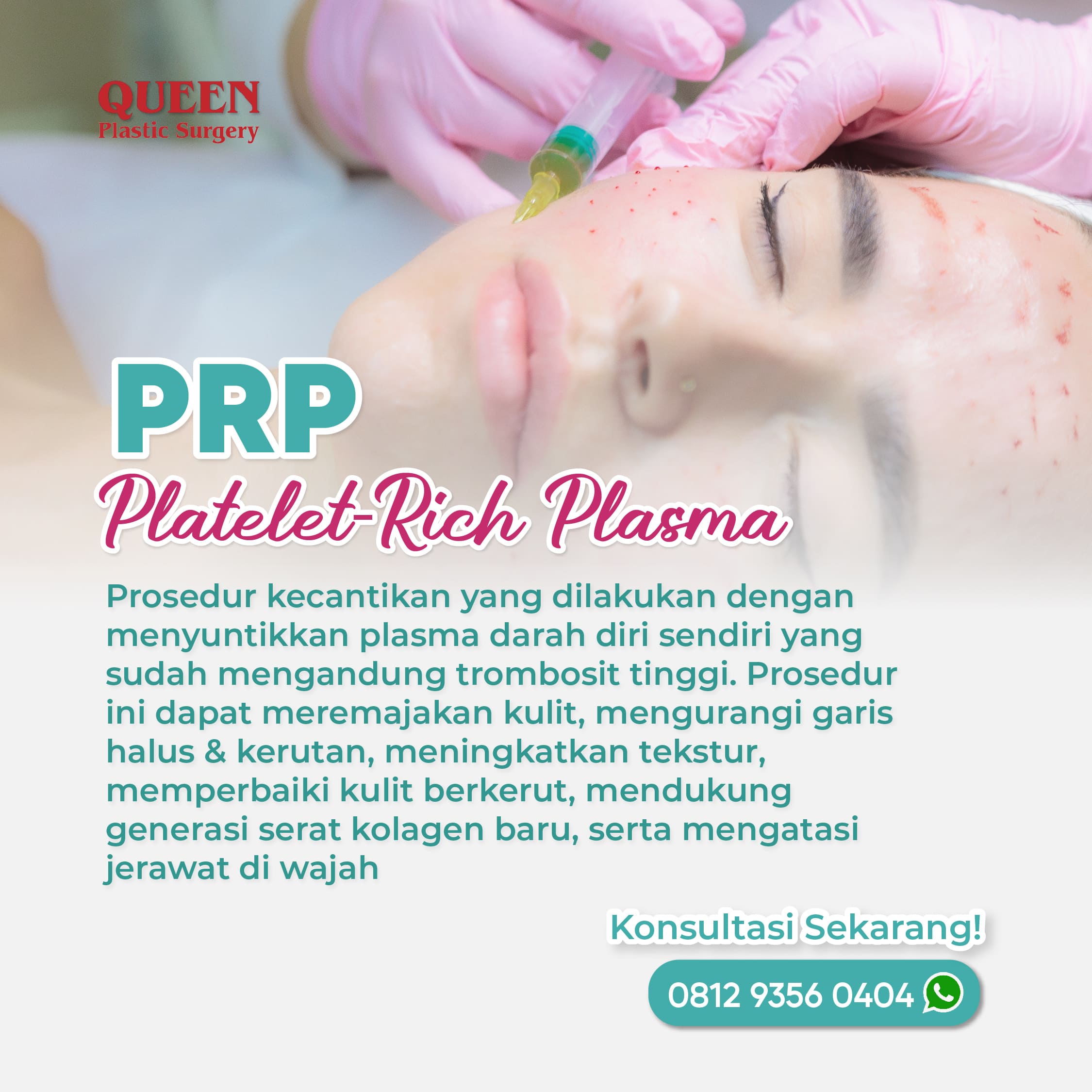 5 Februari-03