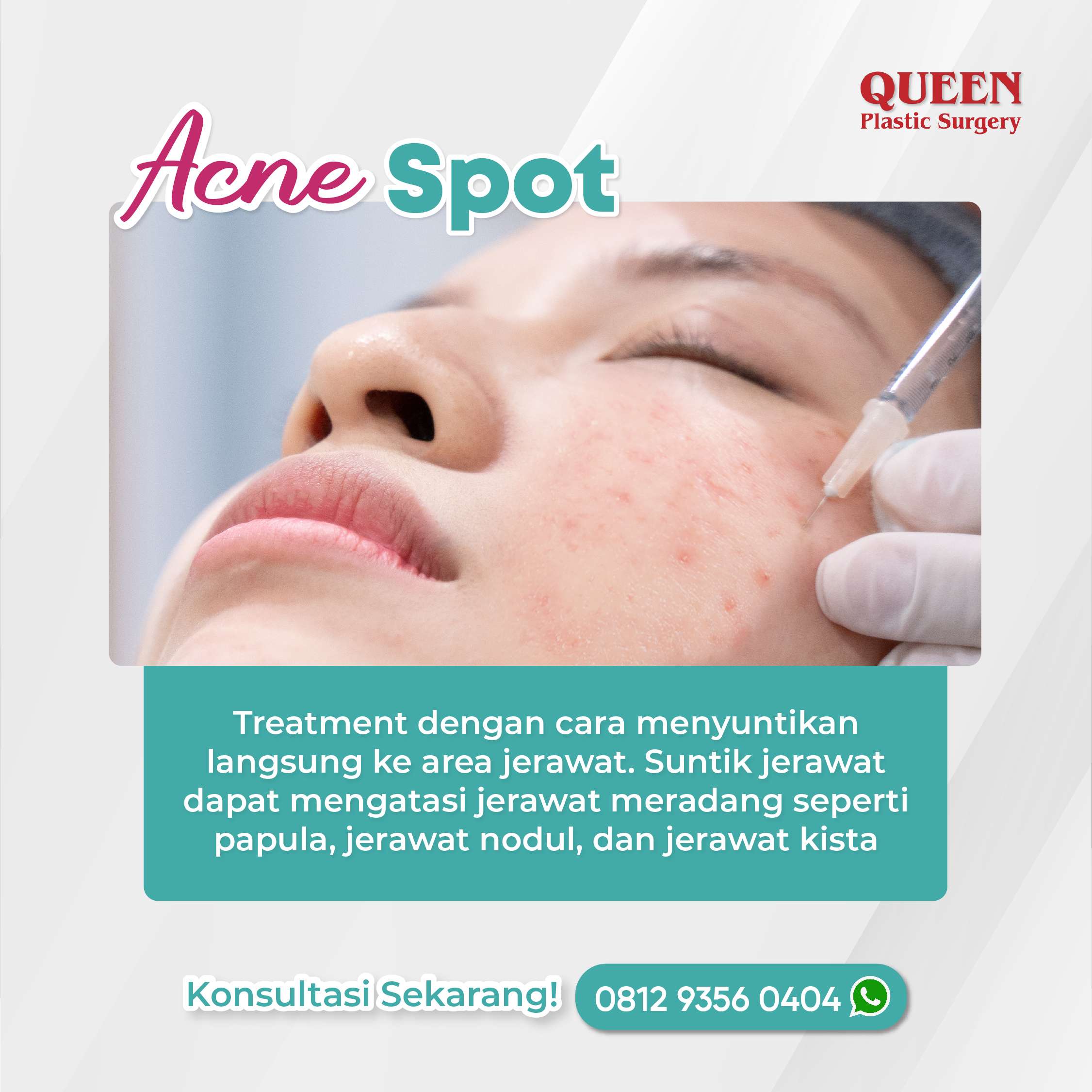 https://queenplasticsurgery.id/wp-content/uploads/2024/02/6-Februari-02-fotor-20240207142948.jpg