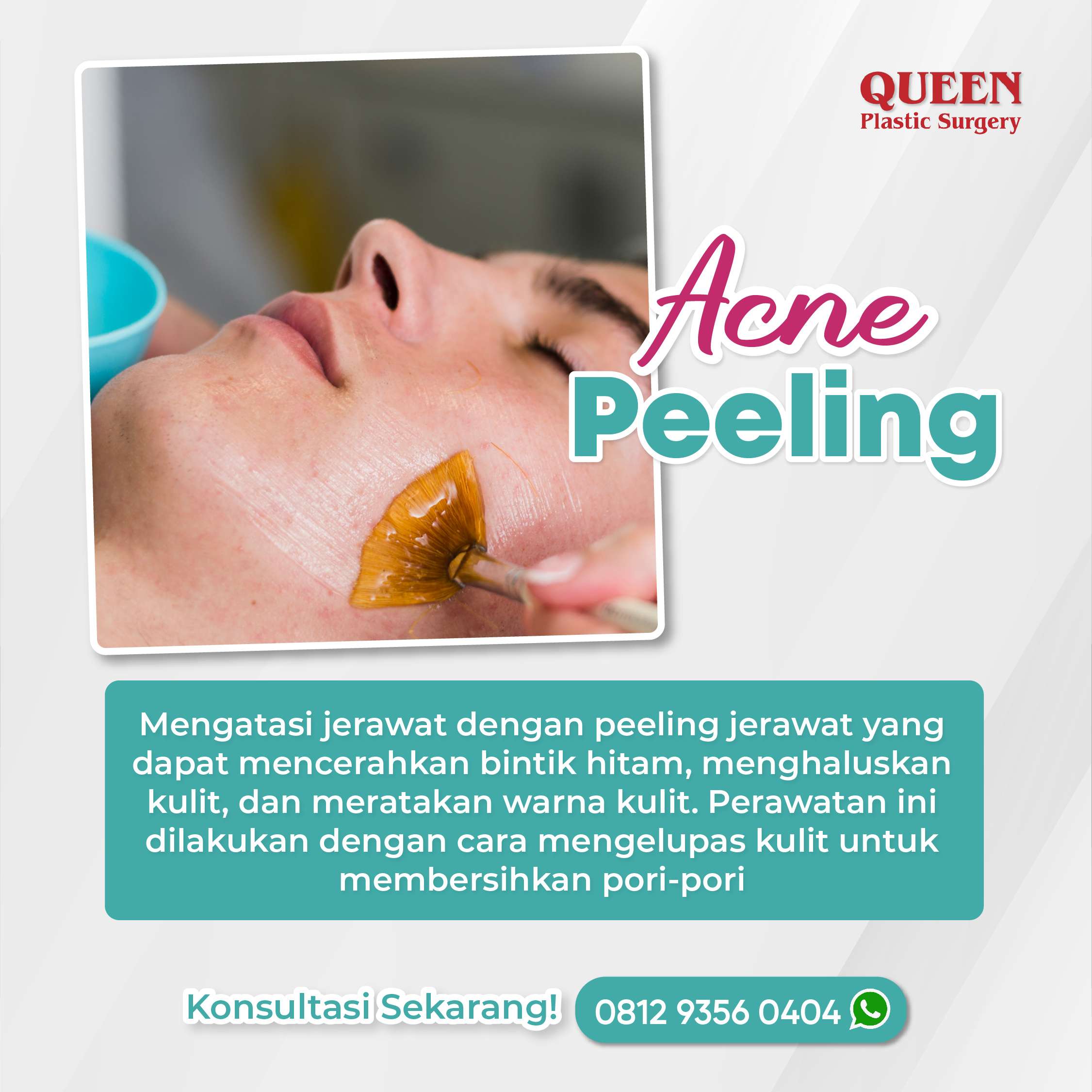 https://queenplasticsurgery.id/wp-content/uploads/2024/02/6-Februari-03-fotor-2024020714301.jpg