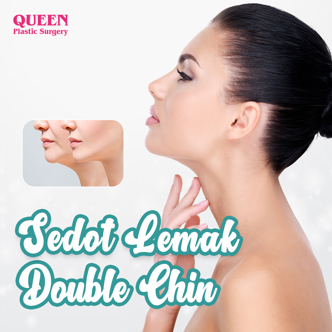 https://queenplasticsurgery.id/wp-content/uploads/2024/02/Cover-Sedot-Lemak-Double-Chin-web.jpg