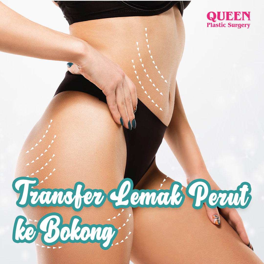 https://queenplasticsurgery.id/wp-content/uploads/2024/02/Cover-Transfer-Lemak-Perut-ke-Bokong-web.jpg