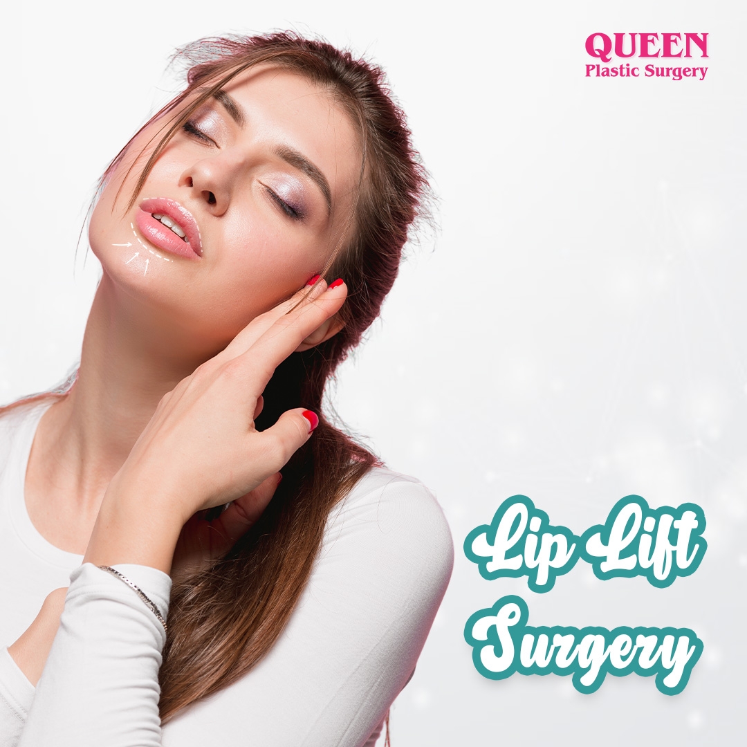 https://queenplasticsurgery.id/wp-content/uploads/2024/02/Lip-Lift-Surgery.jpg