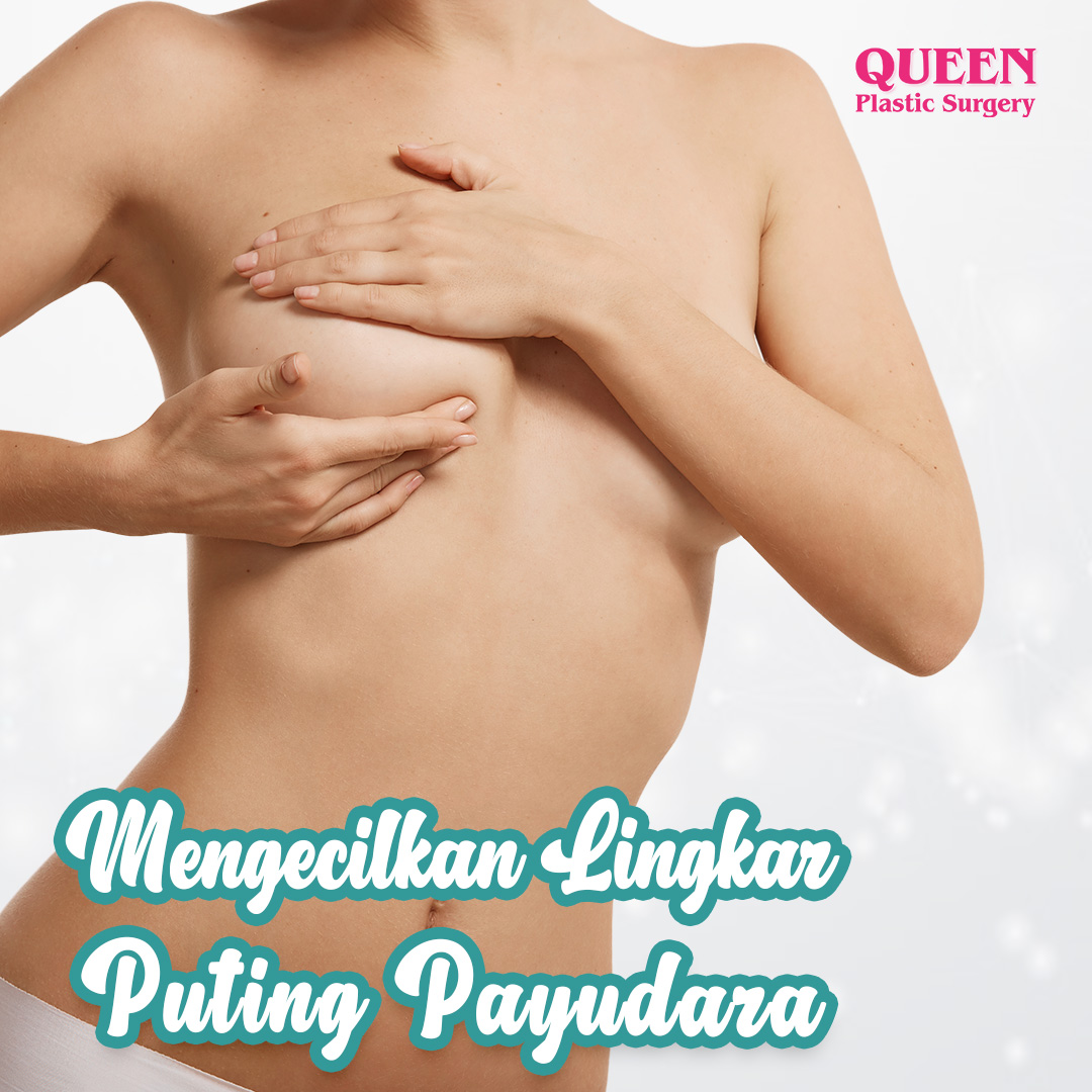 Mengecilkan-Lingkar-Puting-Payudara