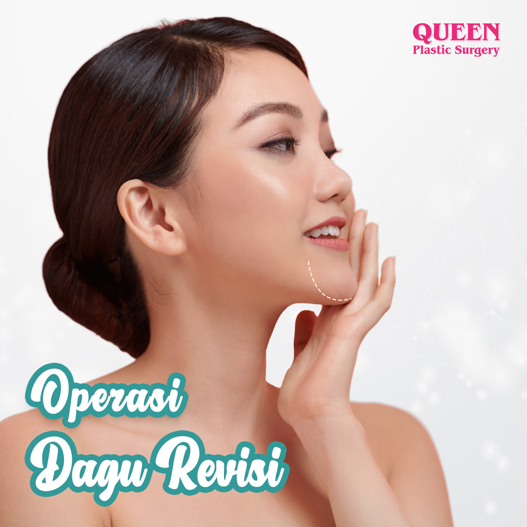 https://queenplasticsurgery.id/wp-content/uploads/2024/02/Operasi-Dagu-Revisi-Web.jpg