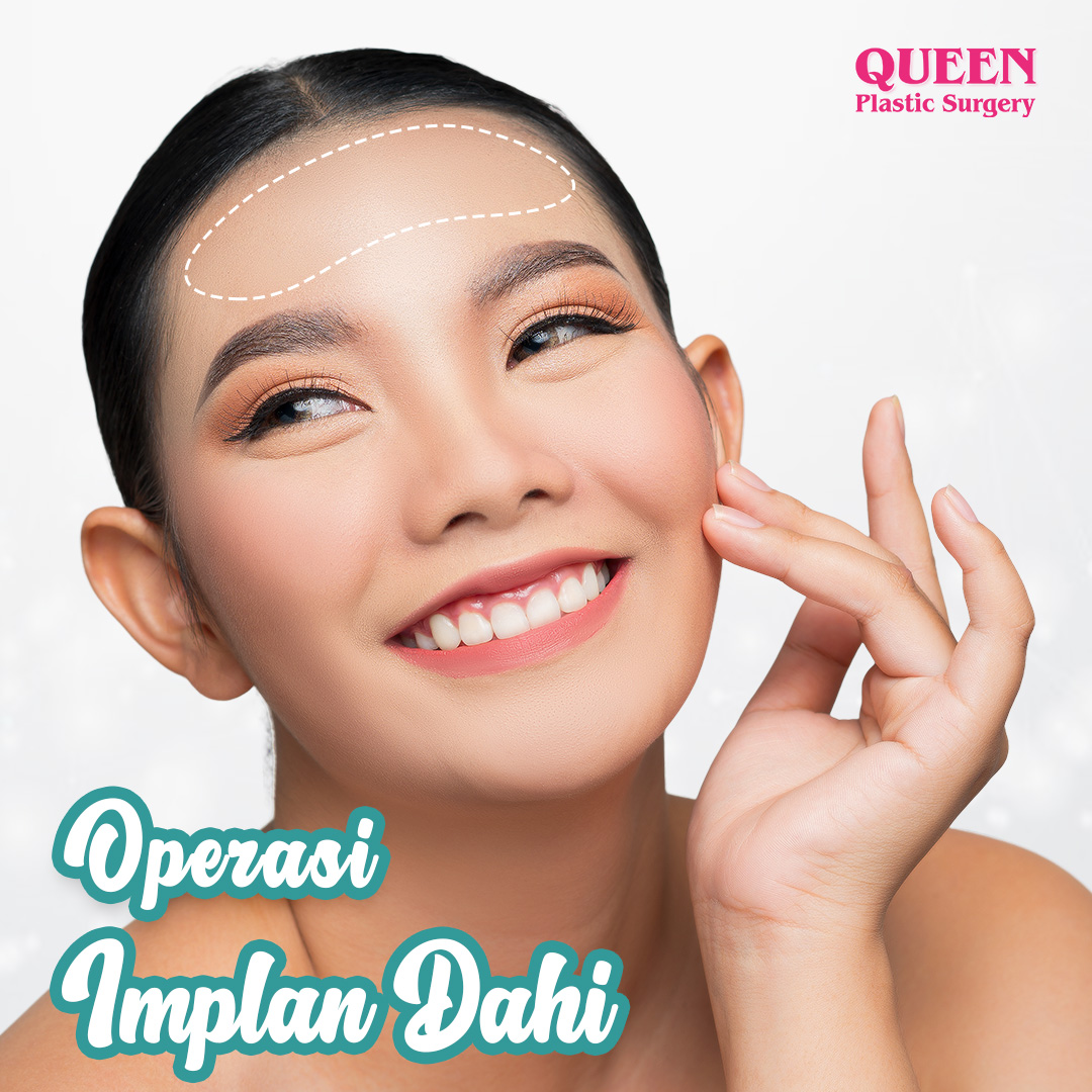 https://queenplasticsurgery.id/wp-content/uploads/2024/02/Operasi-Implan-Dahi.jpg