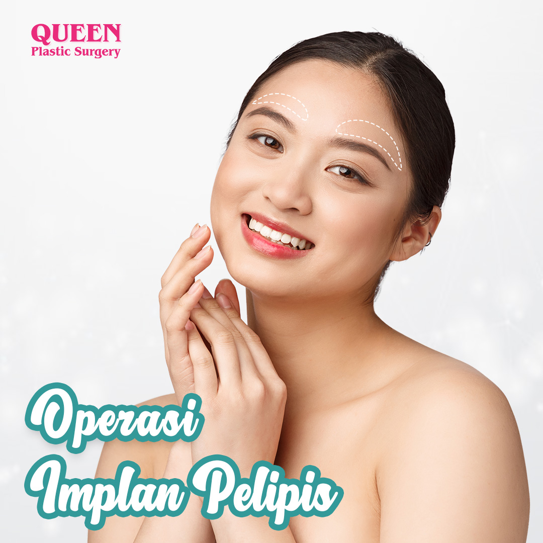 https://queenplasticsurgery.id/wp-content/uploads/2024/02/Operasi-Implan-Pelipis.jpg
