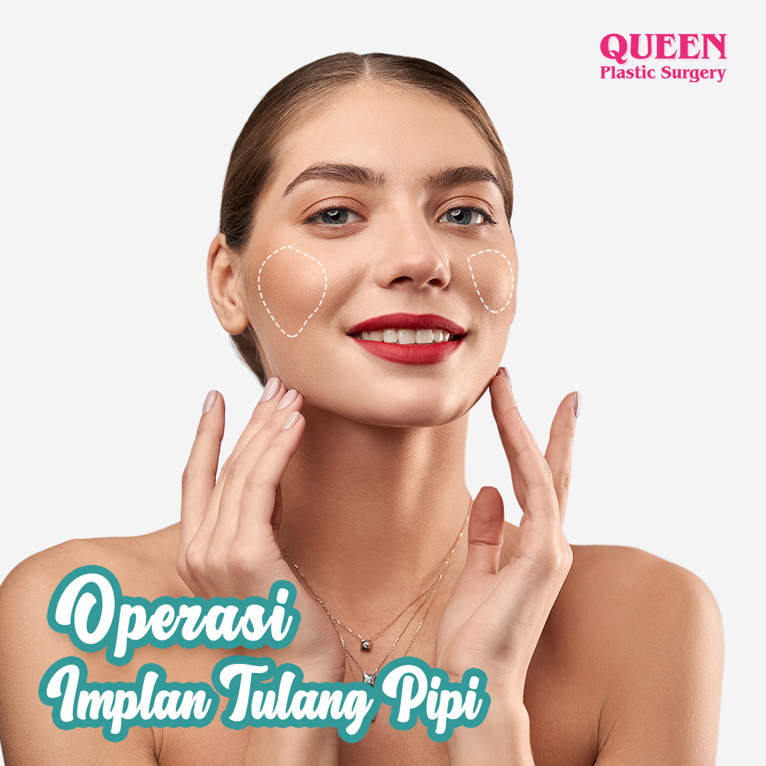 https://queenplasticsurgery.id/wp-content/uploads/2024/02/Operasi-Implan-Tulang-Pipi.jpg
