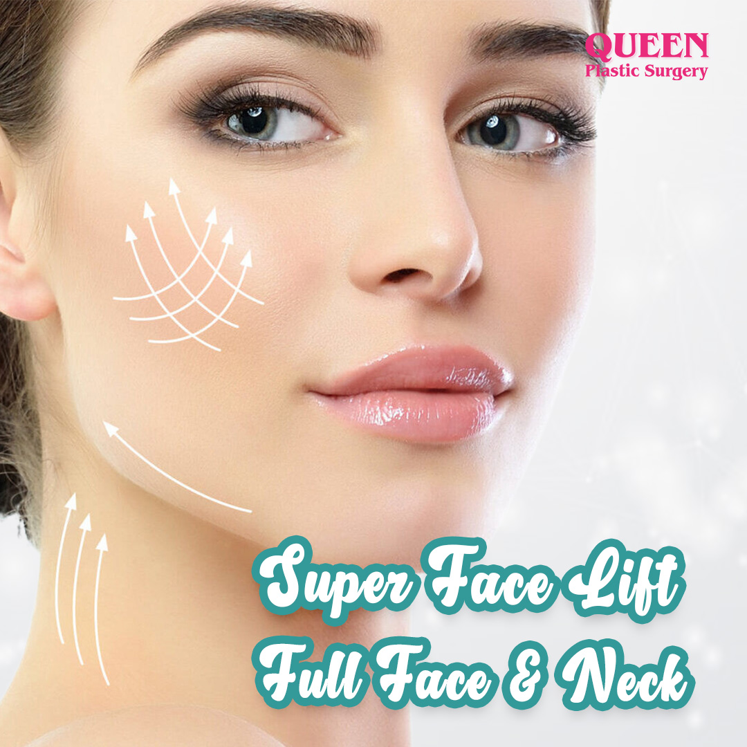 https://queenplasticsurgery.id/wp-content/uploads/2024/02/Super-Face-Lift-Full-Face-n-Neck.jpg