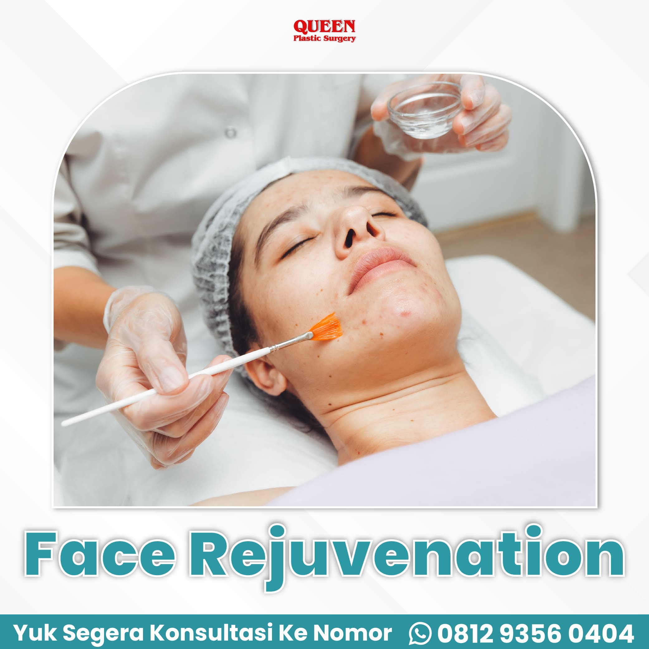 WEB JUDUL TREATMENT (4) https://queenplasticsurgery.id/wp-content/uploads/2024/02/WEB-JUDUL-TREATMENT-4.jpg