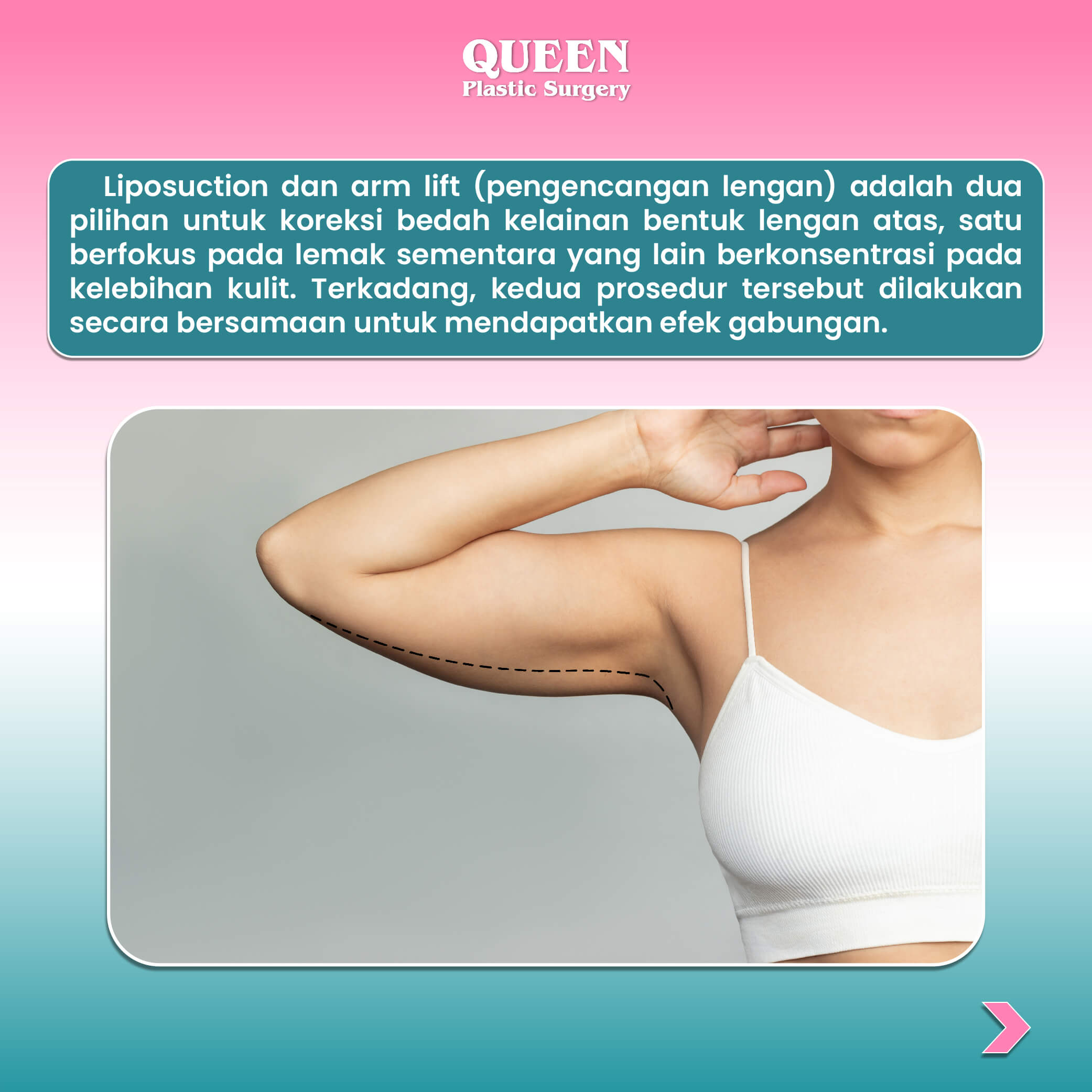 WEB KONTEN ARM (2) (1)