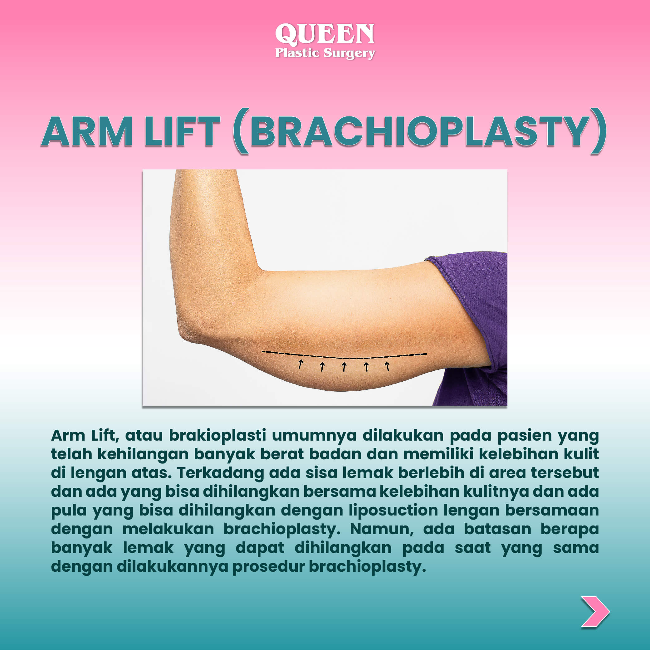 WEB KONTEN ARM (4) (1)