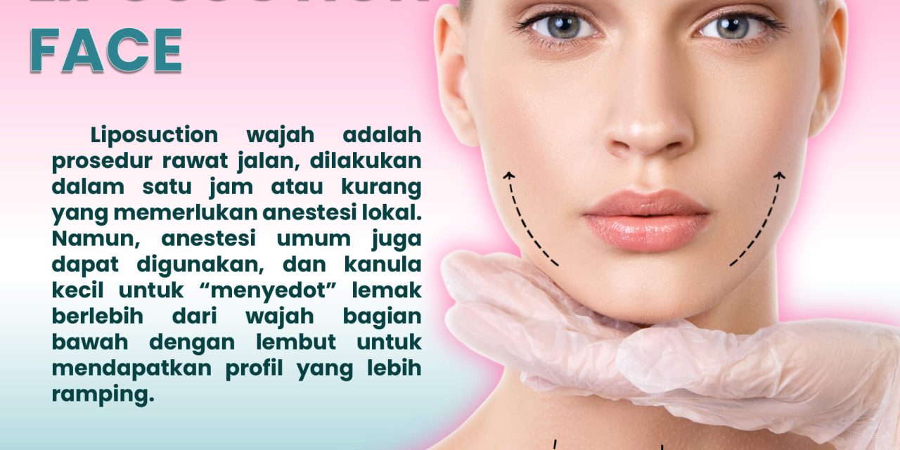 LIPOSUCTION WAJAH