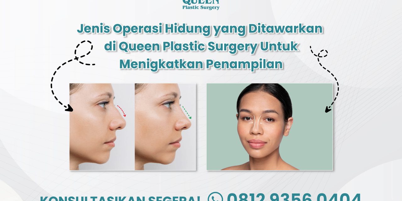 Jenis Operasi Hidung di Queen Plastic Surgery
