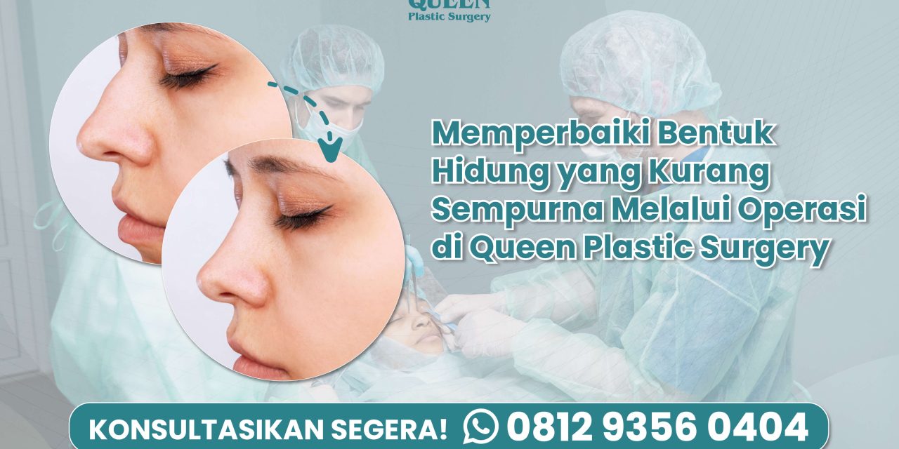 Memperbaiki Bentuk Hidung yang Kurang Sempurna melalui Operasi di Queen Plastic Surgery
