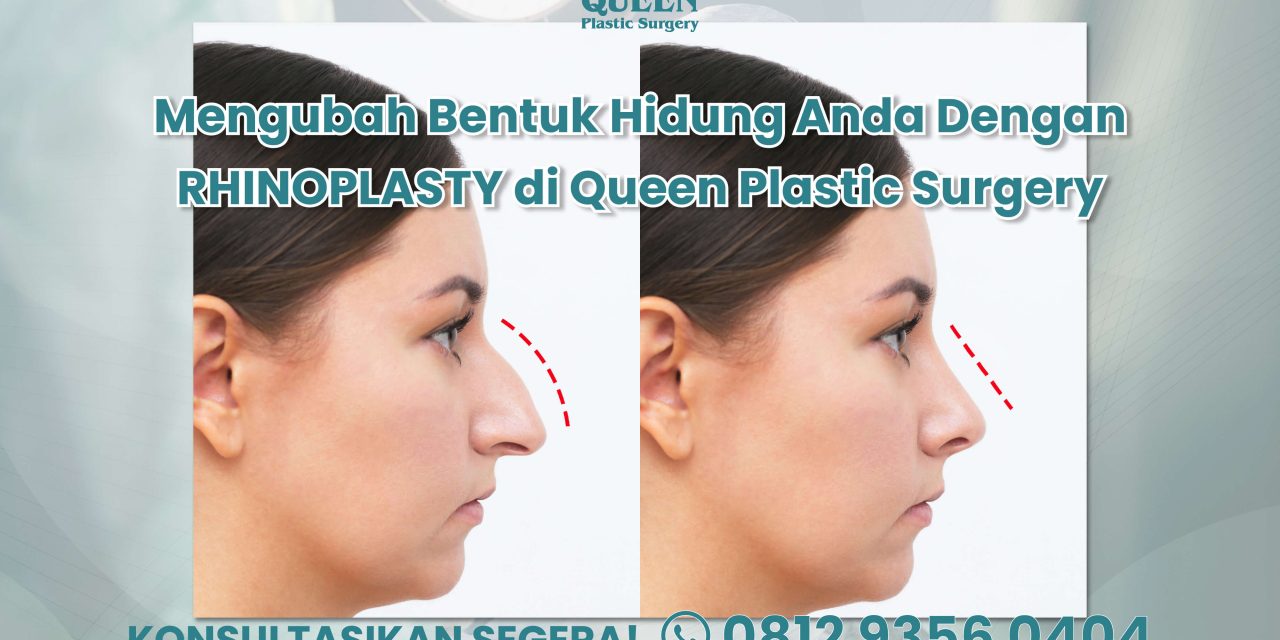 Mengubah Bentuk Hidung Anda dengan Rhinoplasty