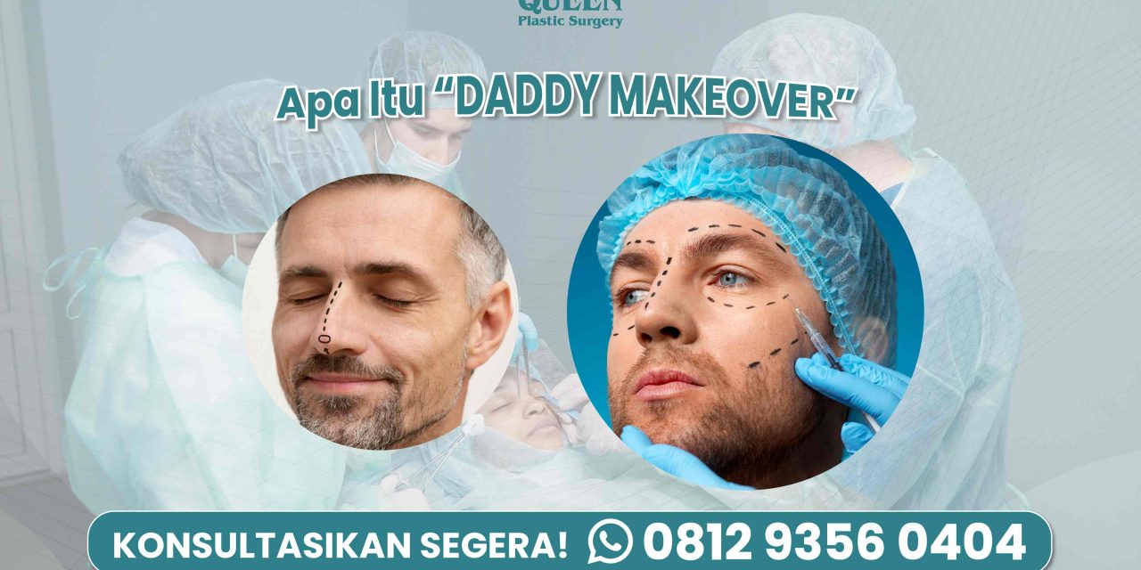 APA ITU “DADDY MAKEOVER“