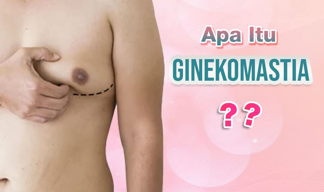 GINEKOMASTIA (PAYUDARA PRIA)