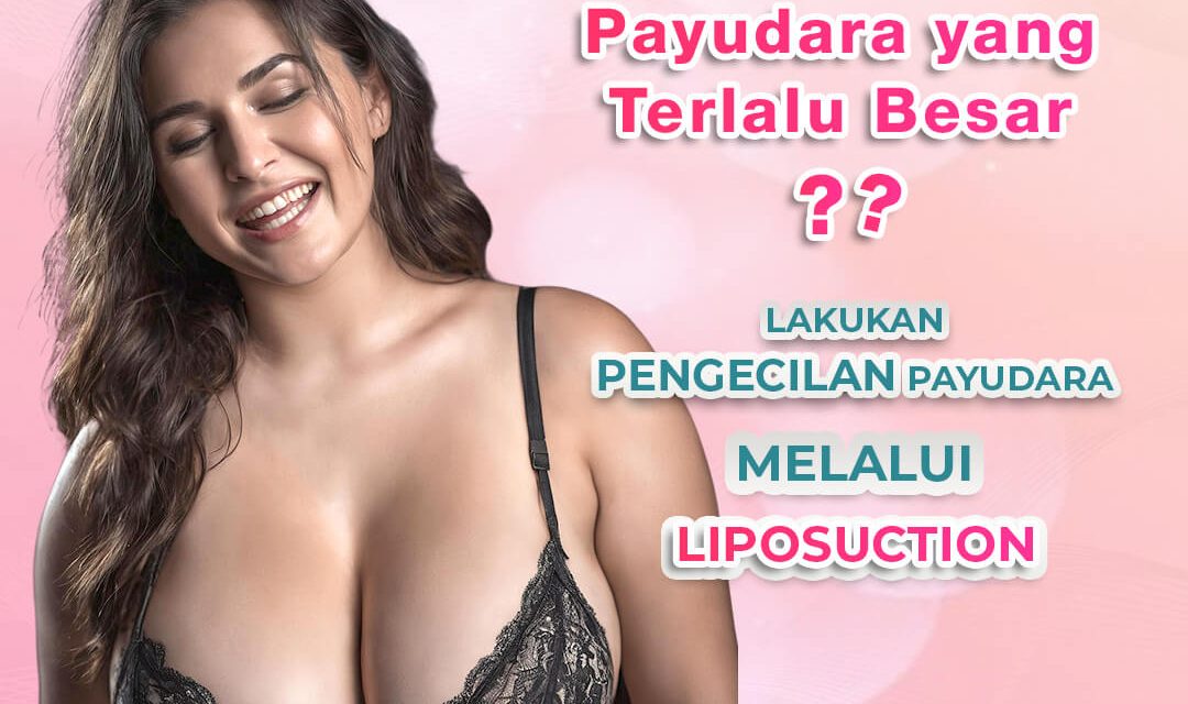 LIPOSUCTION PENGECILAN PAYUDARA
