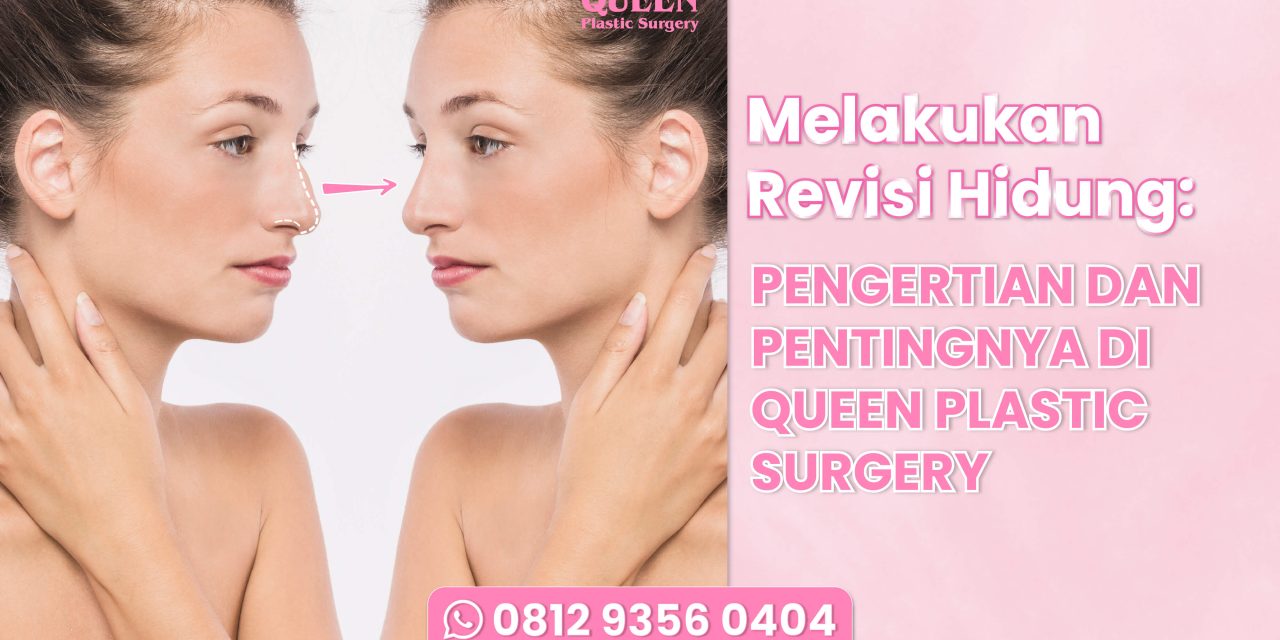 Melakukan Revisi Hidung: Pengertian dan Pentingnya di Queen Plastic Surgery