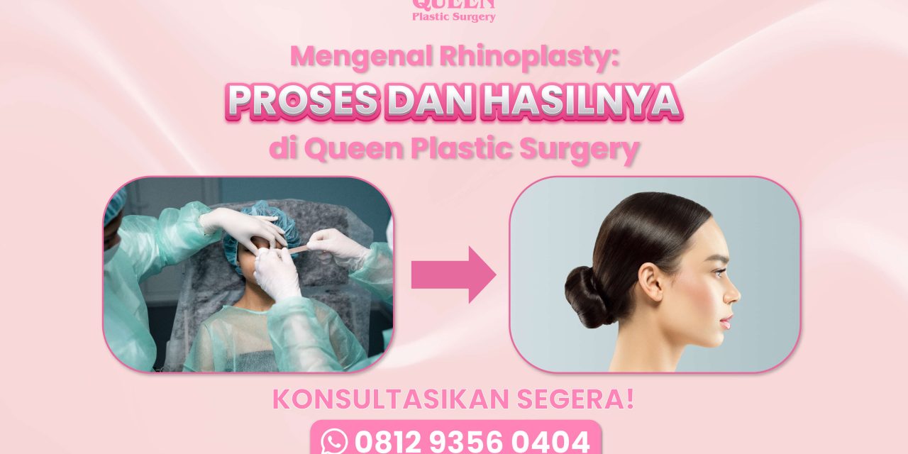 Rhinoplasty Proses Hasilnya di Queen Plastic Surgery