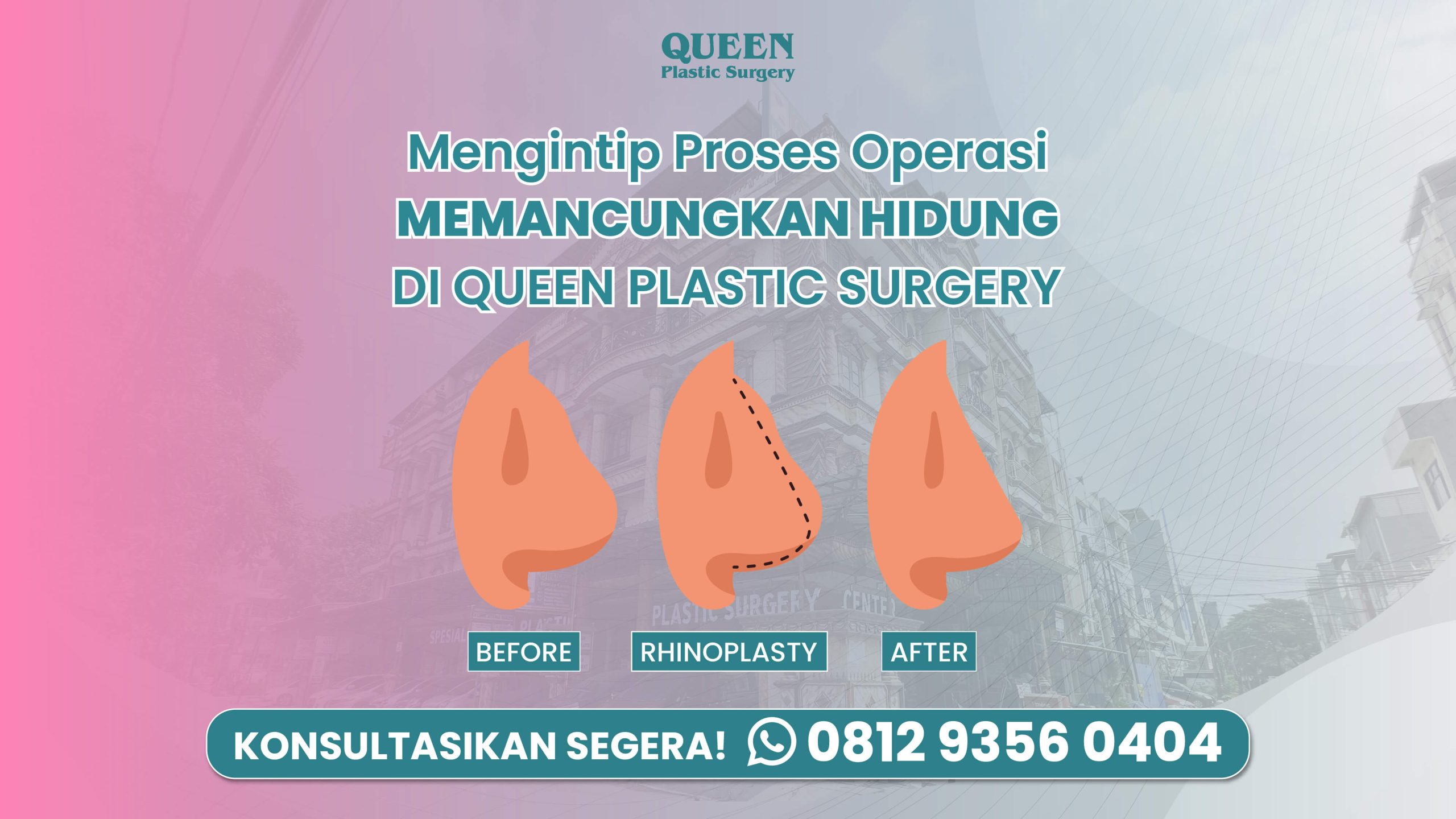https://queenplasticsurgery.id/wp-content/uploads/2024/04/WEB-JUDUK-ARTIKEL-3-3-scaled.jpg