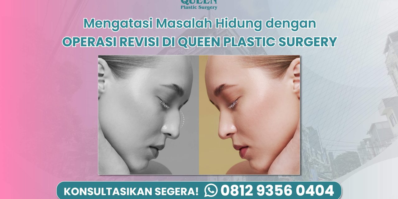 Mengatasi Masalah Hidung dengan Operasi Revisi