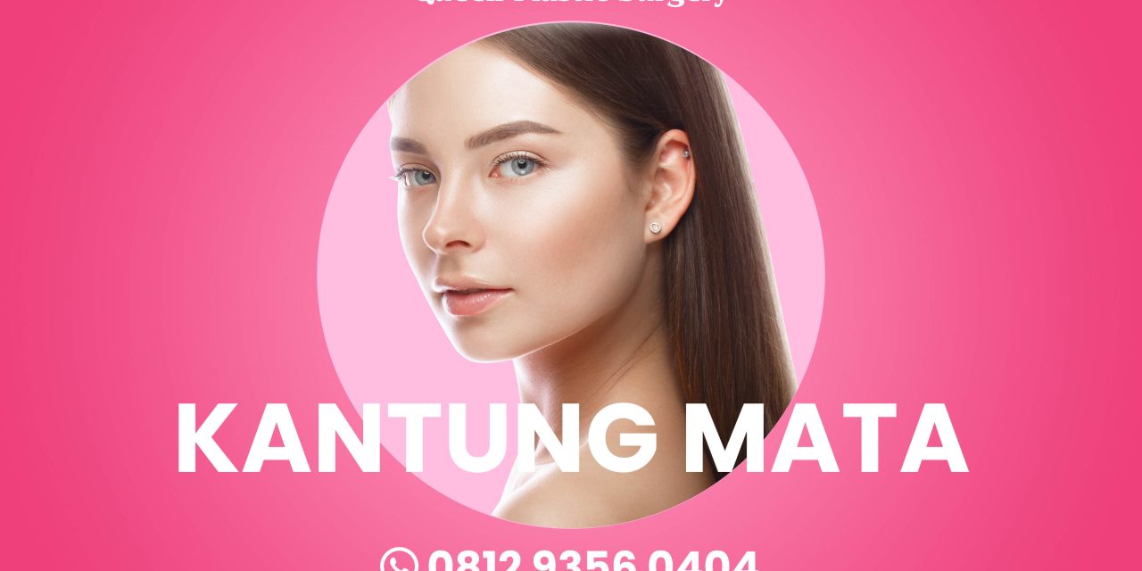 LINGKARAN HITAM BAGAIMANA CARA MENGATASINYA?
