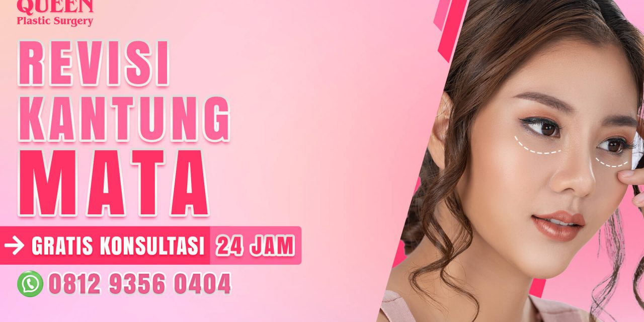OPERASI BLEPHAROPLASTY DAN DAMPAKNYA TERHADAP MATA