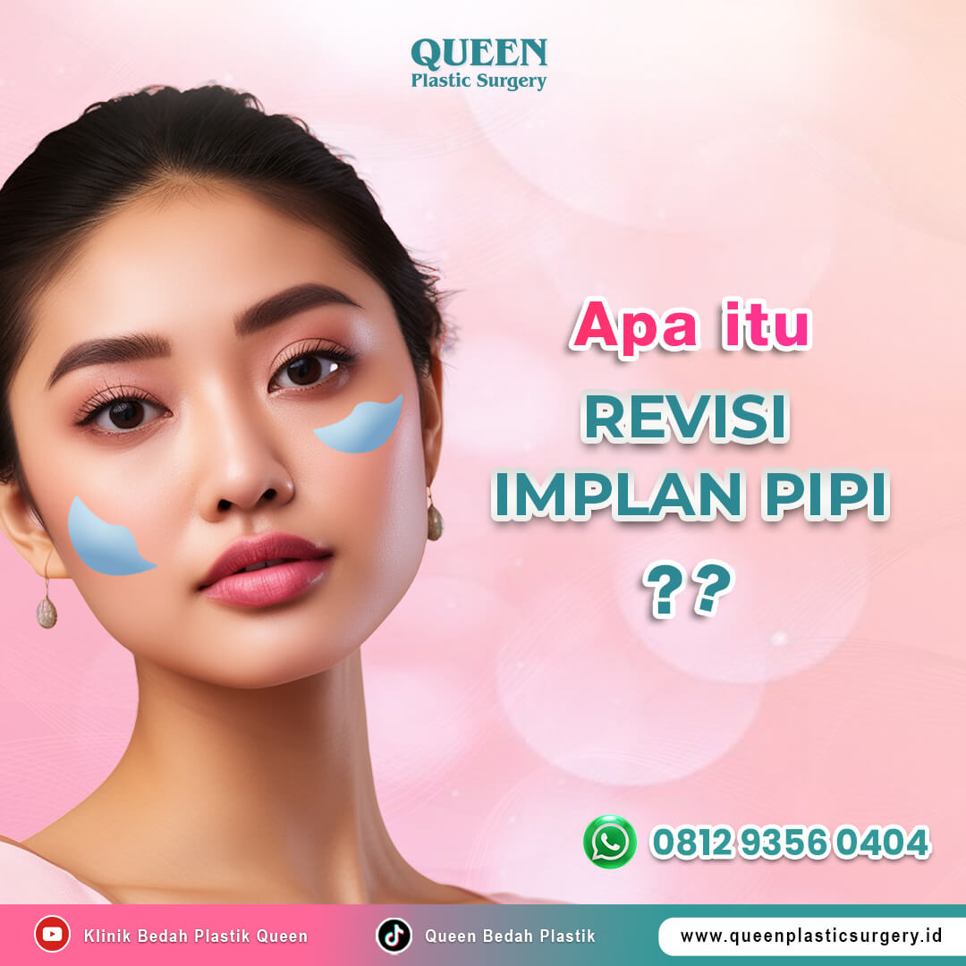Apa-itu-Revisi-Implan-Pipi (1)