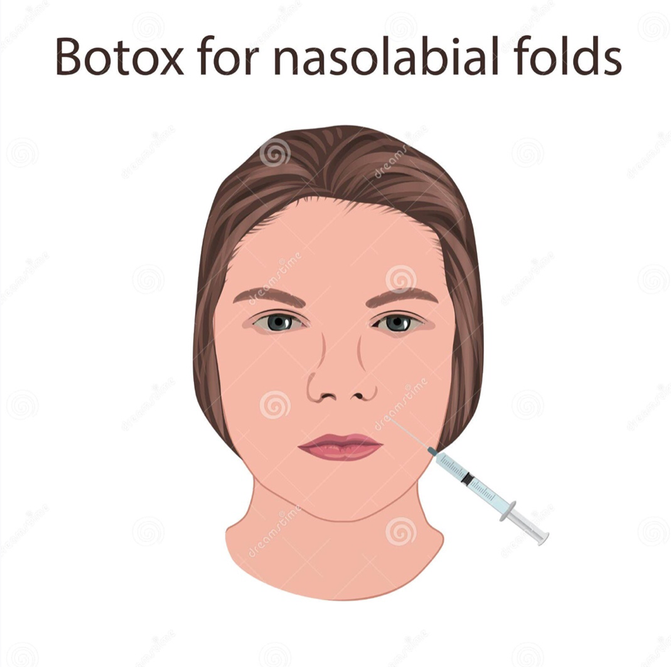 SMILE LINE DAPAT DIATASI DENGAN BOTOX - Klinik Bedah Plastik Queen