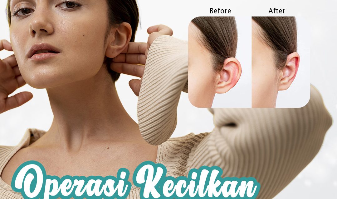 Transformasi Otoplasty Dalam Memberikan Penampilan
