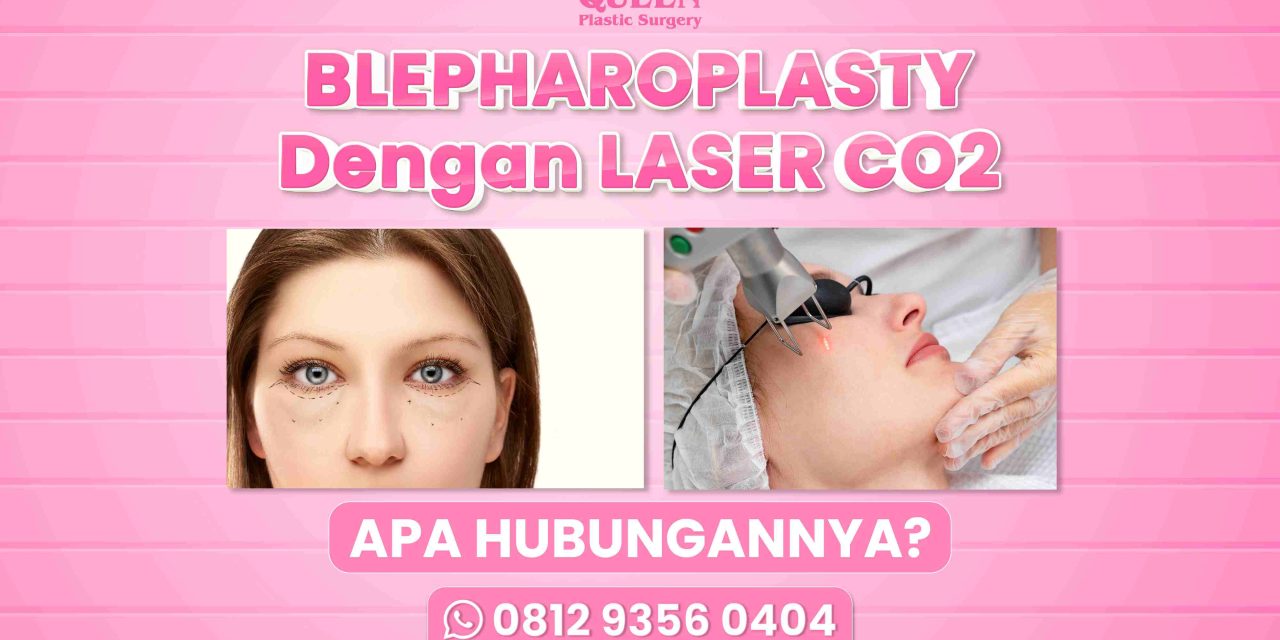 BLEPHAROPLASTY DENGAN LASER CO2