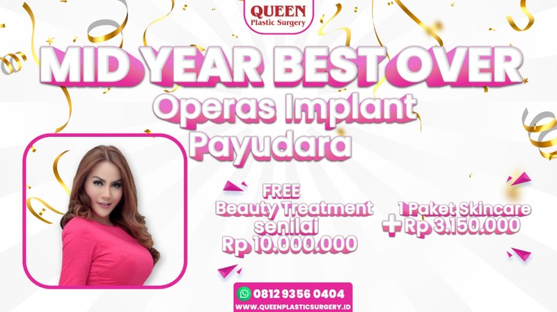 https://queenplasticsurgery.id/wp-content/uploads/2024/06/adv_169.jpg