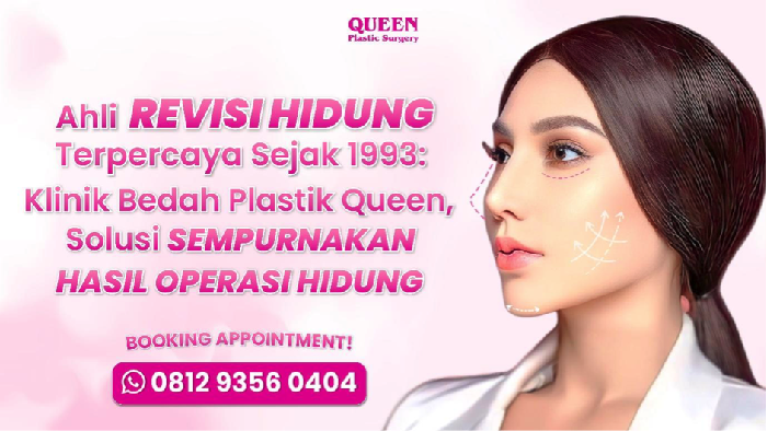 https://queenplasticsurgery.id/wp-content/uploads/2024/06/tagsite-3.png