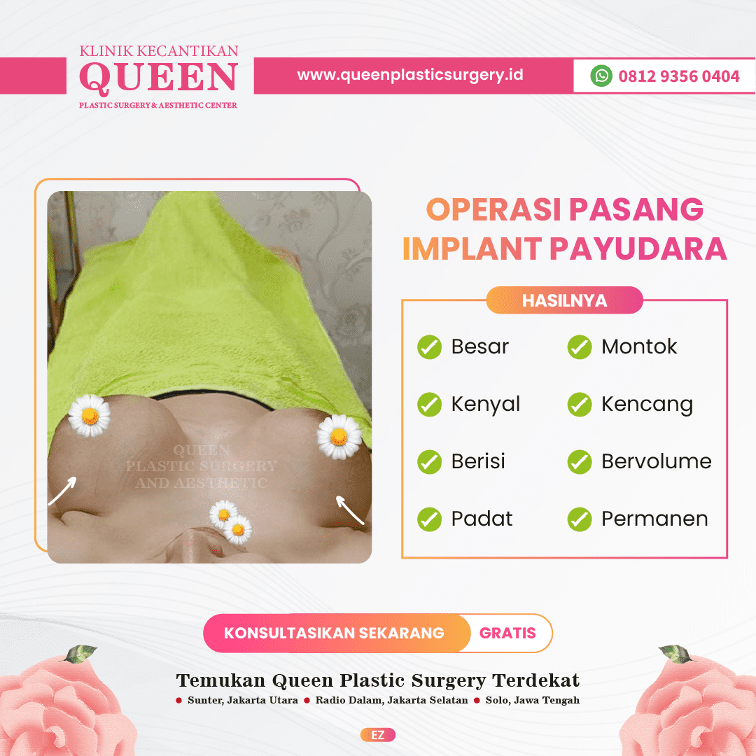 Hasil Breast Implant Queen Plastic Surgery, foto 89