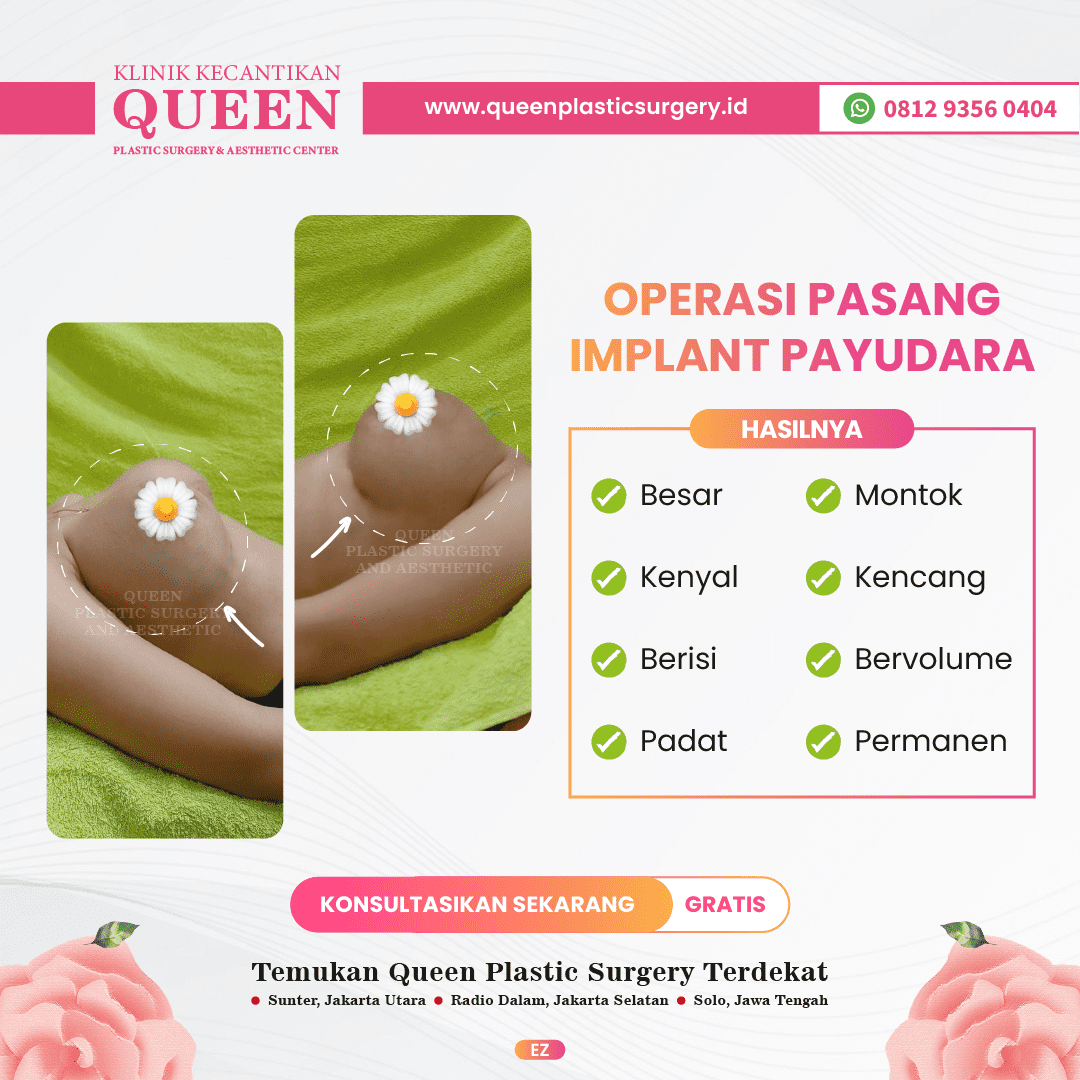 Hasil Breast Implant Queen Plastic Surgery, foto 90