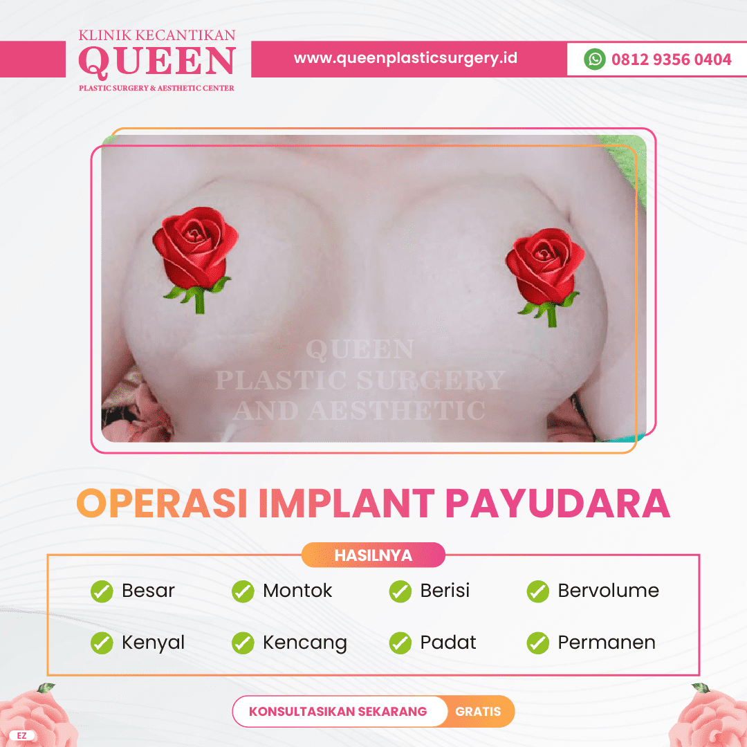 Hasil Breast Implant Queen Plastic Surgery, foto 57