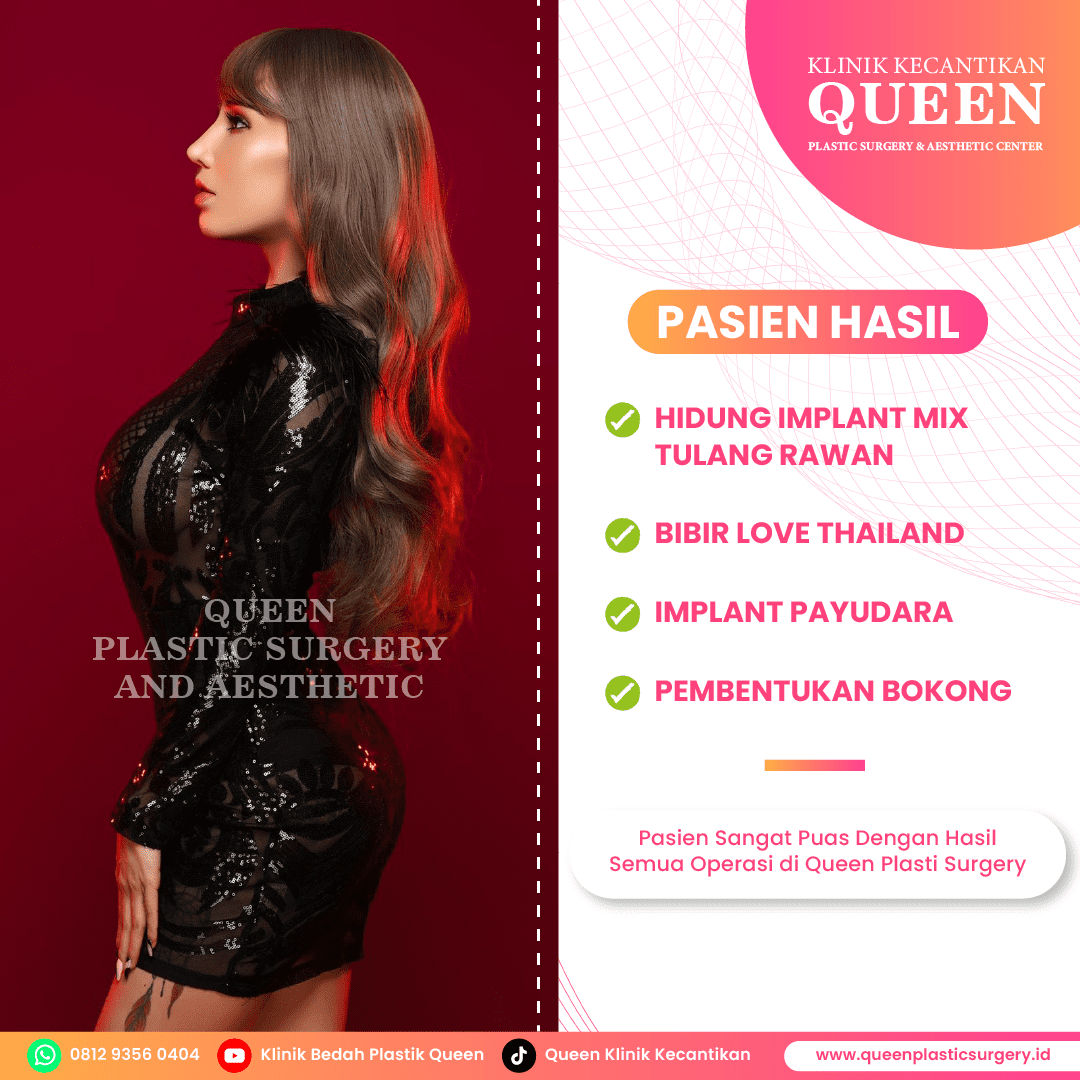 Ingin Payudara Lebih Besar? Revisi Augmentasi Payudara yang Tepat
