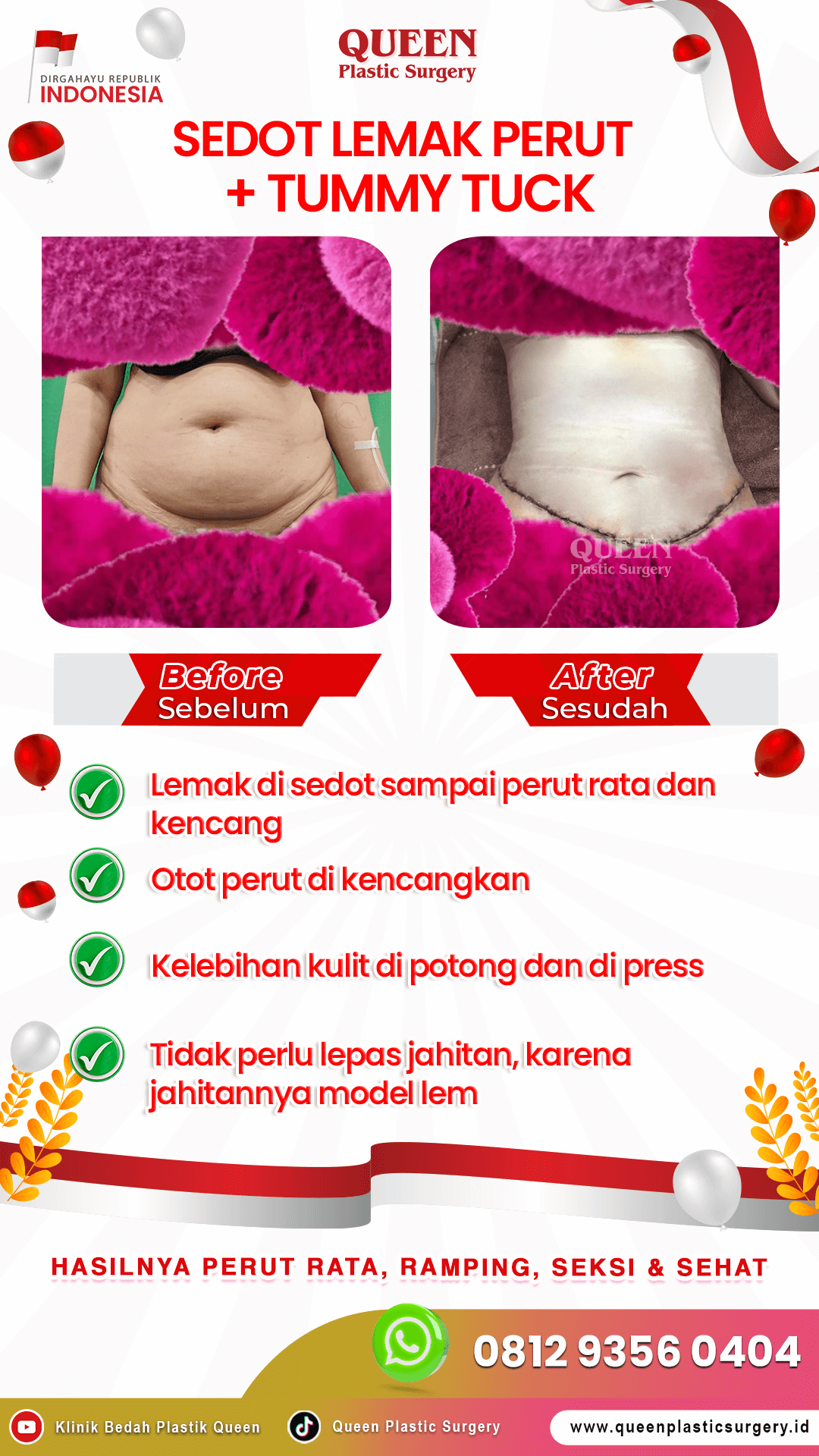 JANGAN PANIK! INI PENYEBAB RASA GATAL SETELAH LIPOSUCTION