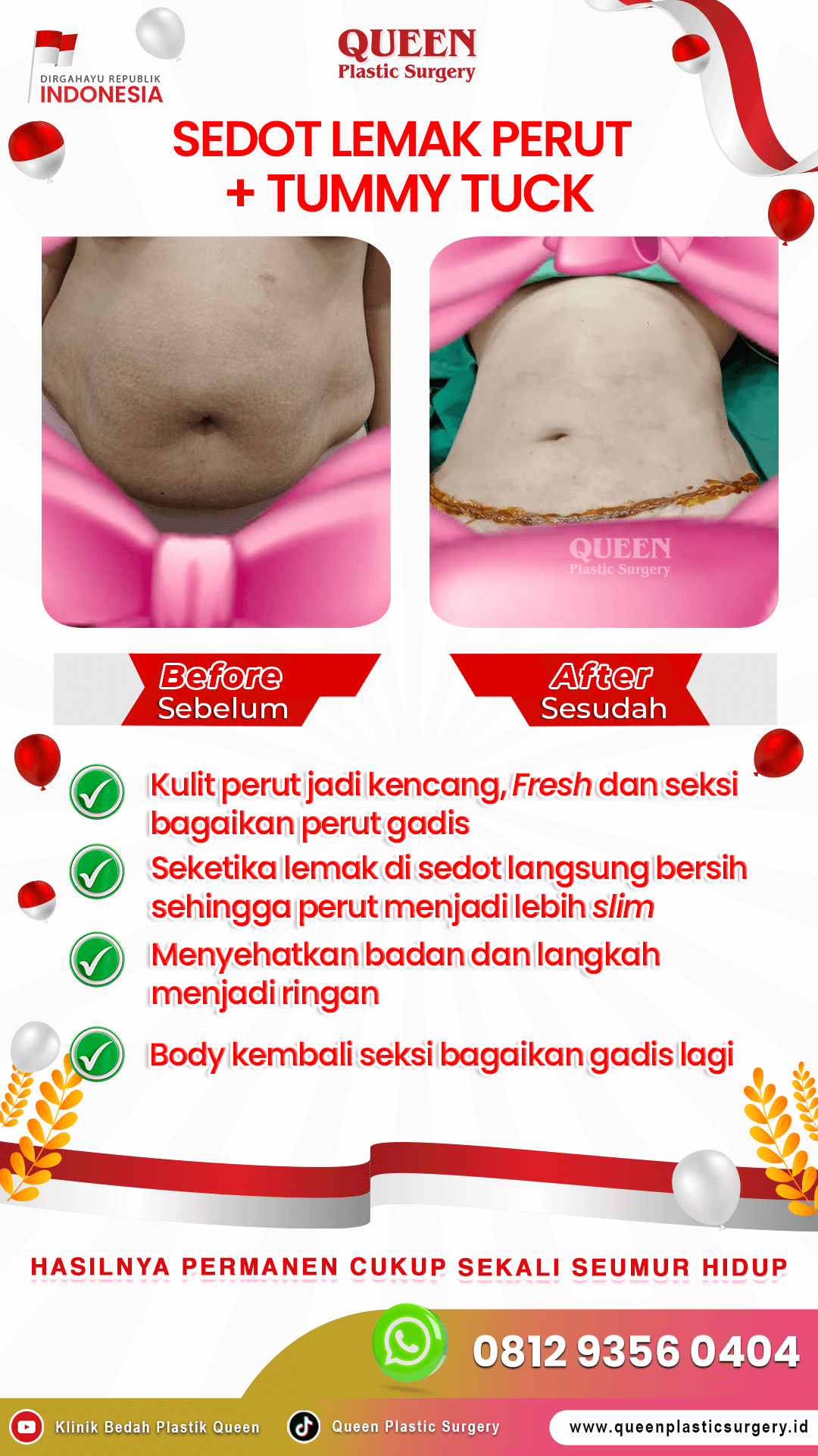 JANGAN PANIK! INI PENYEBAB RASA GATAL SETELAH LIPOSUCTION