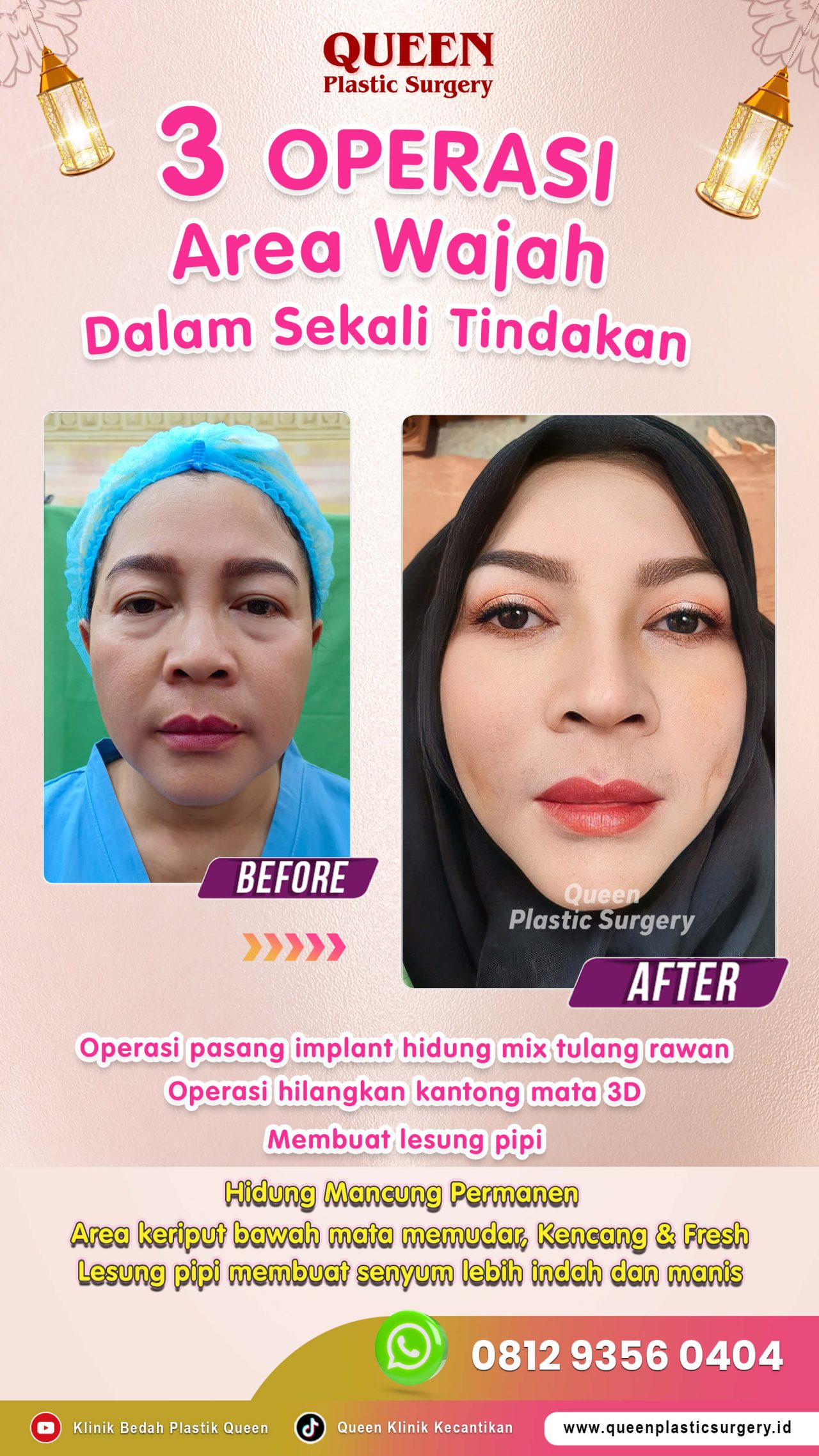 3-Operasi-Area-Wajah-dalam-sekali-Tindakan