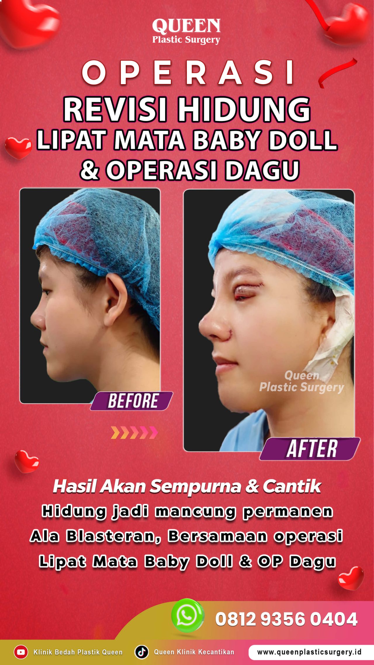 3-Operasi-Sekaligus-02