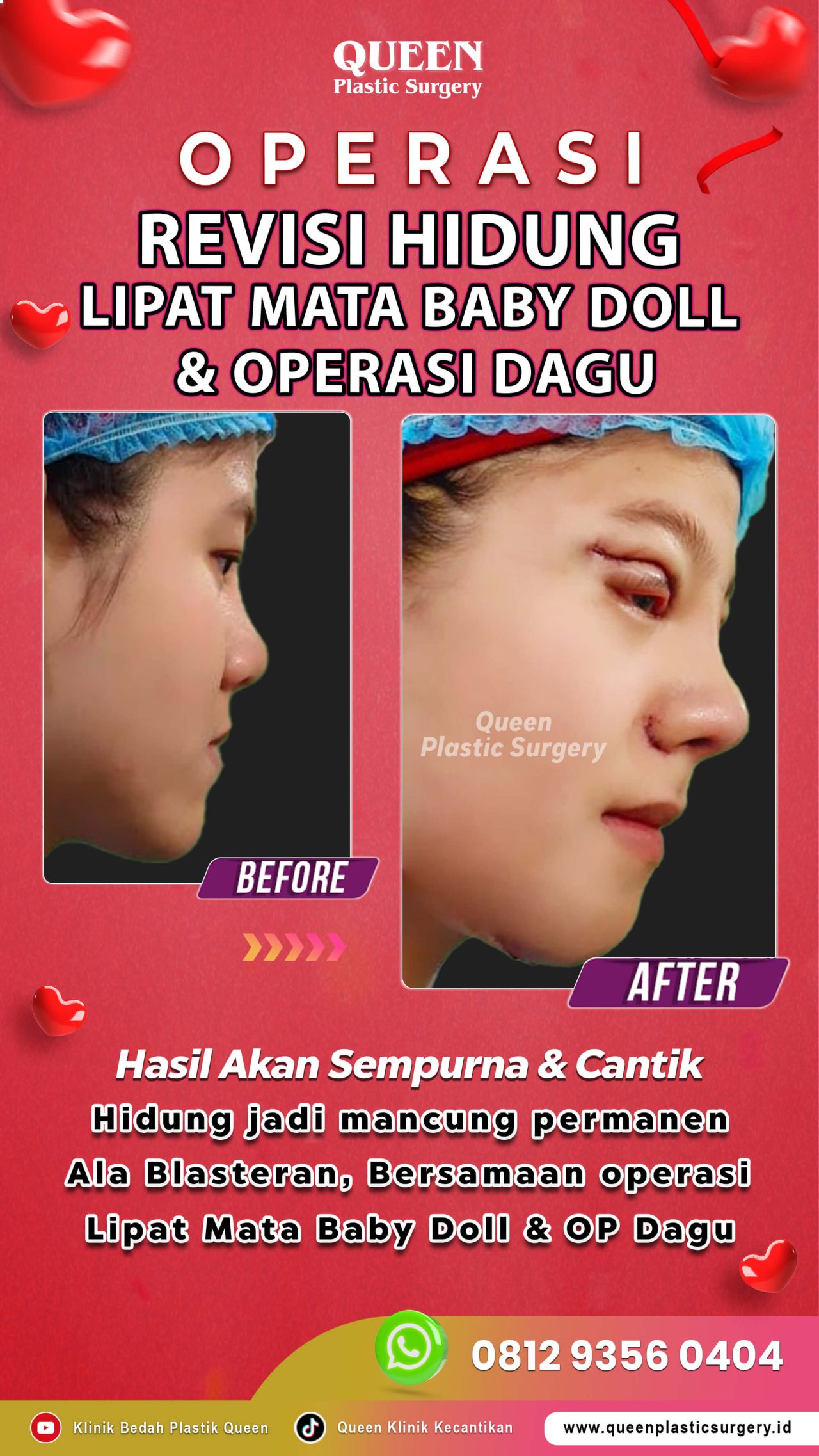 3-Operasi-Sekaligus