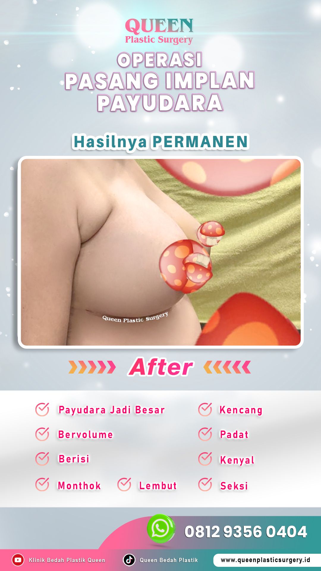 AFTER-Operasi-Pasang-Implan-Payudara-04-fotor-2024060311010