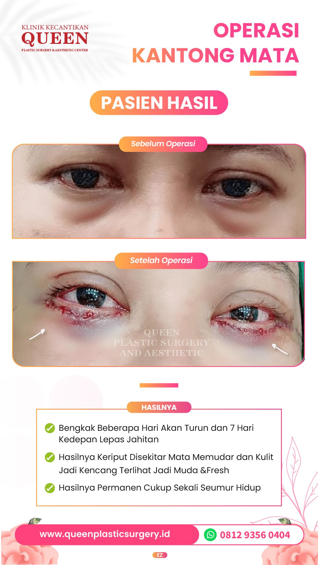 Design Queen 1-02-fotor-20240401161421